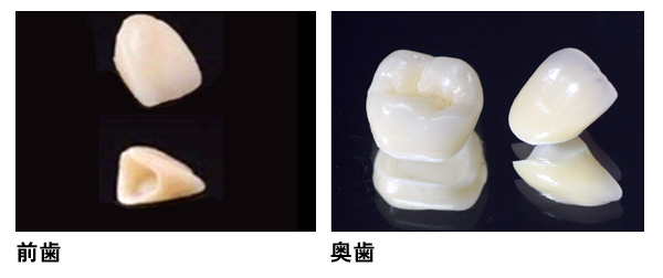 ジルコニアセラミック
